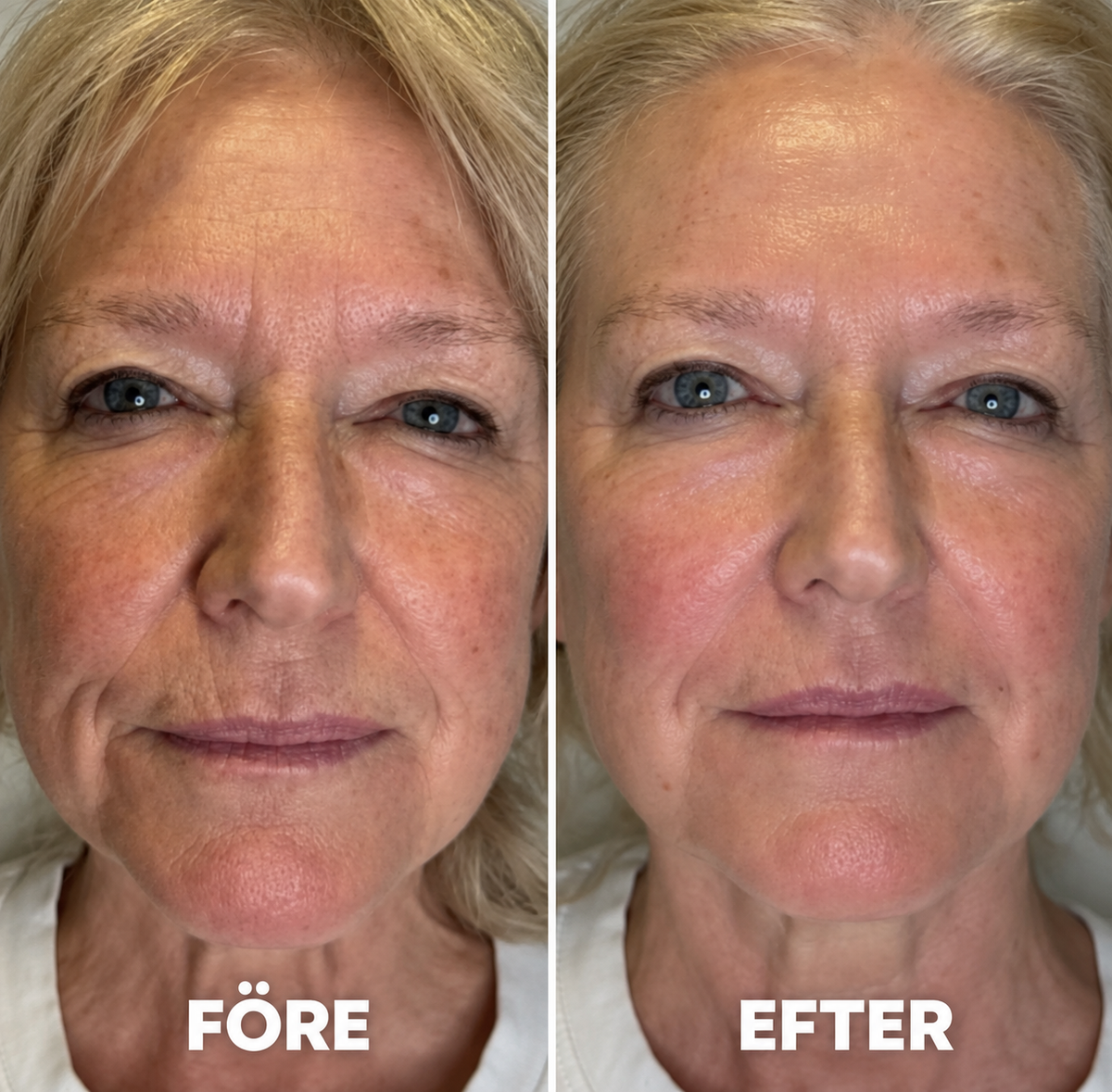 Renuvia Kollagen Volume Balm – För Huden Som Tappat Sin Glöd